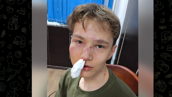 Алматыда саябақта жасөспірім соққыға жығылды: жақындары куәгерлерді іздеуде