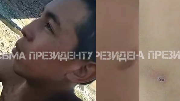 “Денемнің бәрі жара”: Жамбыл облысындағы балалар құлдығына қатысты сұмдық дерек шықты (ВИДЕО)