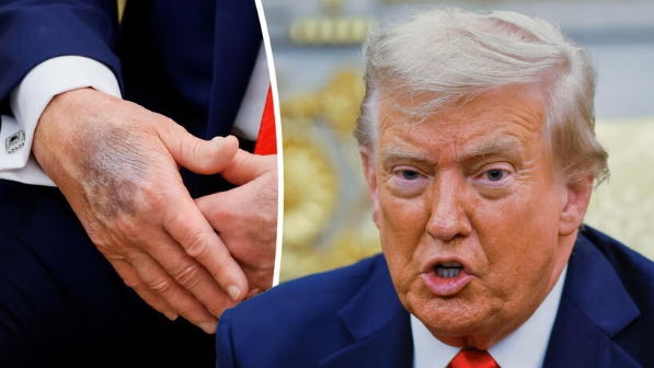 “Трамптың қайтыс болғаны туралы қауесет қаншалықты рас?” - Ақ үй шұғыл мәлімдеме жасады