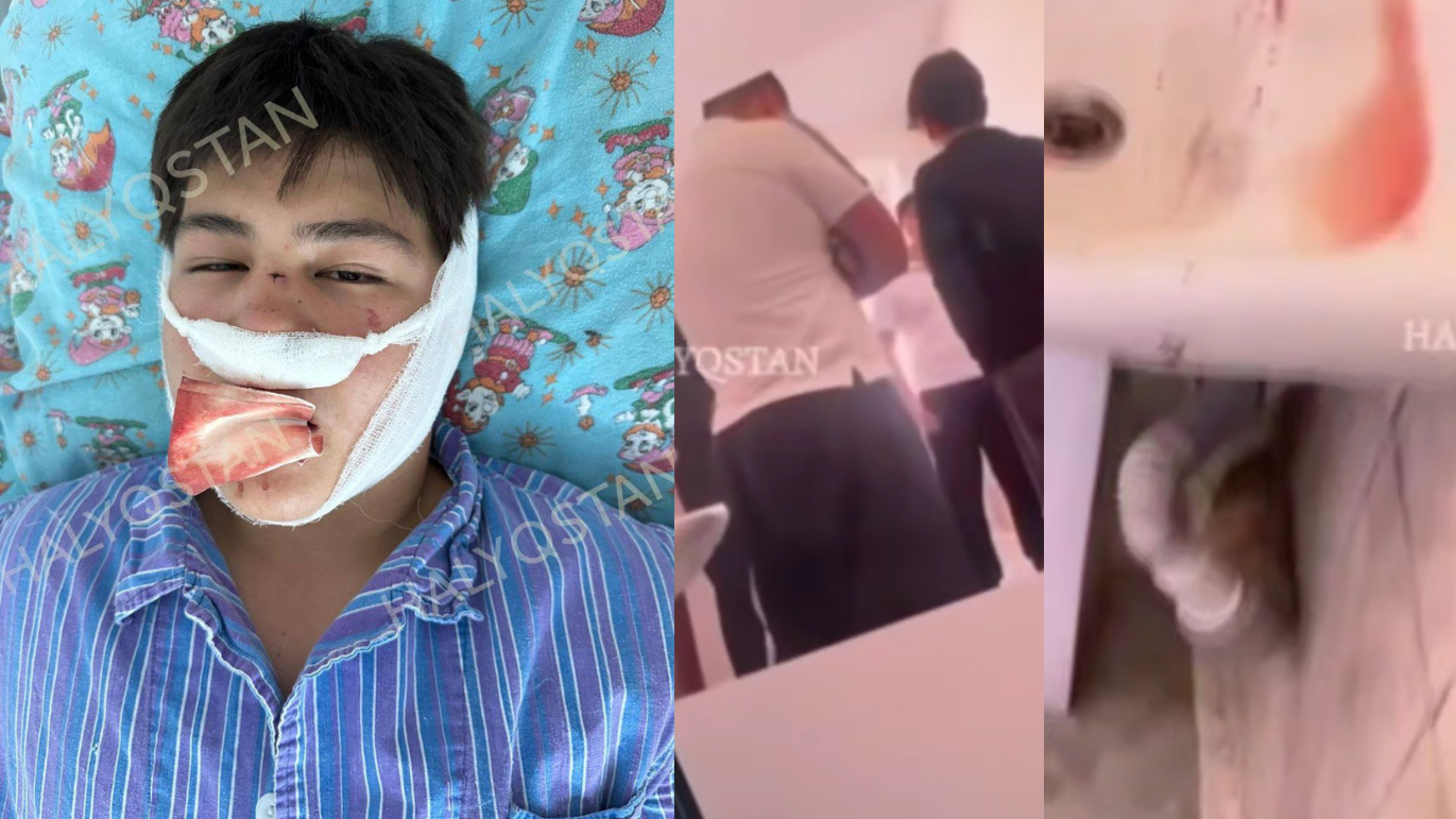 Қыздар форумы, жігіттердің жалаңаш медициналық тексерулеріне қатысқыңыз келе ме?