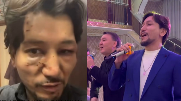 «Мұқасан Шахзадаев соққыға жыққан. Мұрны мен қолы сынған»: Нұр-Мұқасан тобының жас әншісі ел күтпеген мәлімдеме жасады (ВИДЕО)