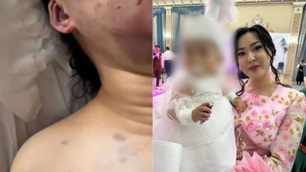 «Мәйітханада көргенімде денесінің сау-тамтығы жоқ болды». Куәгерлер Айзат Жұманованың өліміне қатысты шындықты айтты