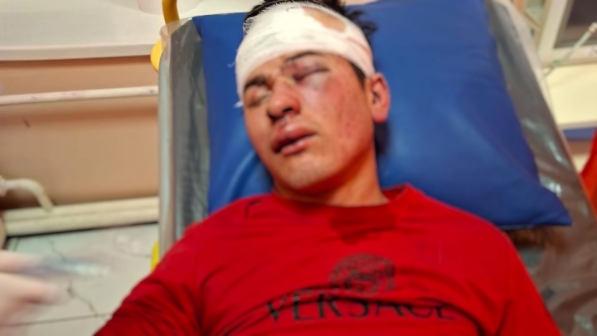 “Басынан теуіп, талып қалғанша жәбір көрсеткен”: Түркістан облысында 20 жастағы жігіт комаға түсті