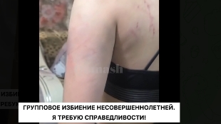 "Алты жасөспірім оқушыны соққыға жыққан". Қарағандыда кәмелеттік жасқа толмаған қызды соққыға жығып, денесін көгерткендер туралы ақпарат шықты