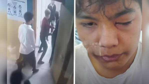 «Миы шайқалып, көз түбі толық зақымданған»: Тараздағы оқушылар төбелесі жайлы сұмдық ақпарат тарады (ВИДЕО)