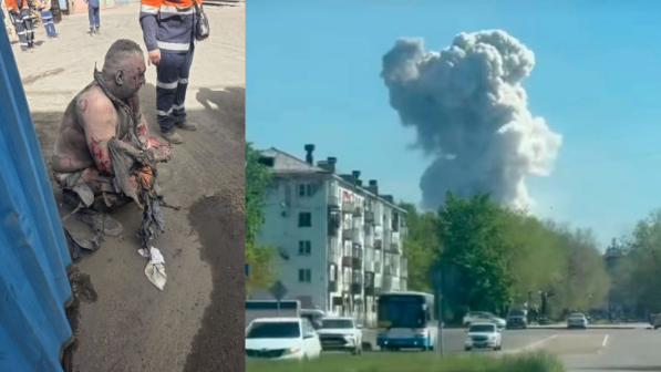 «Денесінің 90 пайызын күйік шалған»: Өскемендегі жарылыстан зардап шеккендердің жағдайы белгілі болды 