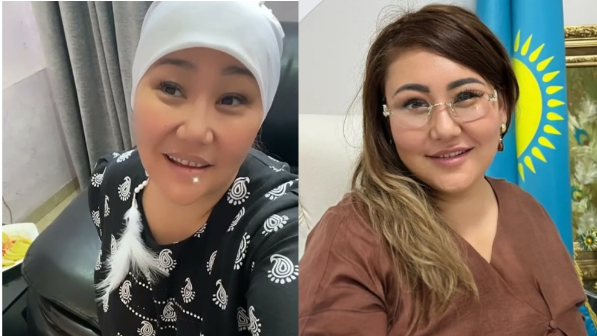 «Ұнамаса, неге келесіңдер?»: Бағдагүл сынықшы өткір мәлімдеме жасады